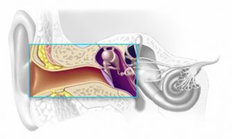 Conductive Hearing Loss