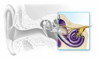 sensorineural hearing loss